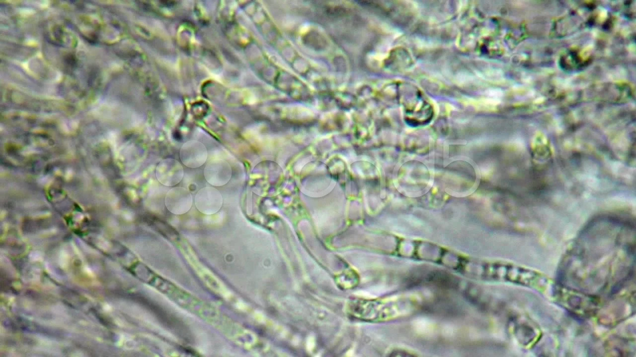 Одноклеточный таллом с ризомицелием. Клетка мицелия гриба. Строение мицелия низших грибов. Рассмотрите микропрепарат плесени гриба мукора. Неклеточный мицелий грибов схема.