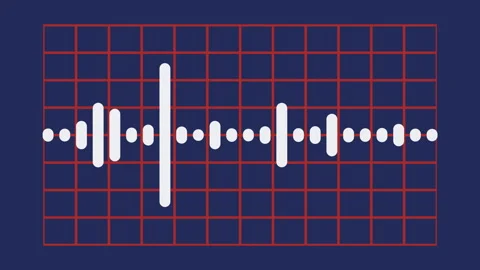Music equalizer on grid background, retro style color palette, signal of playing Stock Footage 262371918