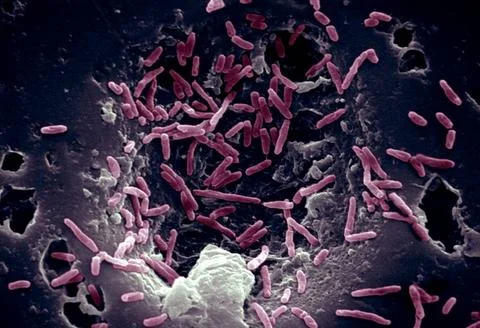  Mycobacterium chelonae Scanning Electron Micrograph of Mycobacterium chel... Stock Photos