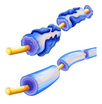 Myelin deterioration Stock Illustration