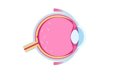 Myodesopsia eye floaters Illustrazione stock