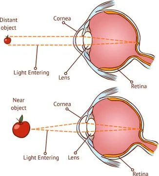 Myopia and normal vision ( color  vector illustration ) Stock Illustration