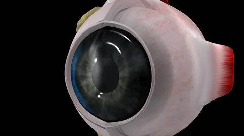 MYOPIA EYE LENS Video stock 40633517