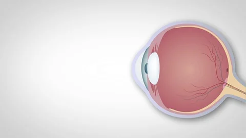 Myopia, hyperopia, astigmatism Vidéo 98258562