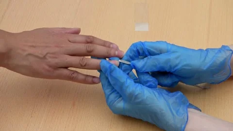 Nail examination Stock Footage 311782647
