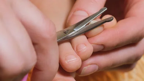 A nail with scissors on the child's leg Stock Footage 131121837