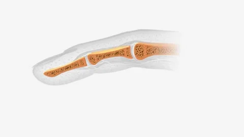 Nail section of bone Stock Footage 270143832