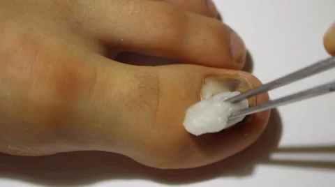 Nail treatment Vídeo Stock 56537397