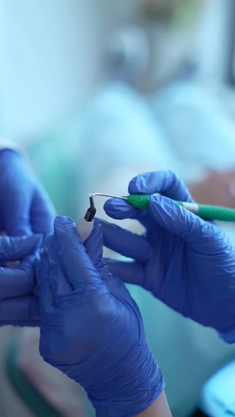 Nail Treatment in Progress Stock Footage 316916437
