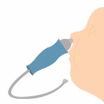 Nasal aspirator Stock Illustration