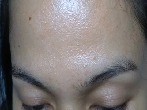 Natural Bare Forehead and Eyebrows of Asian Woman No Makeup Stock Footage 241635132