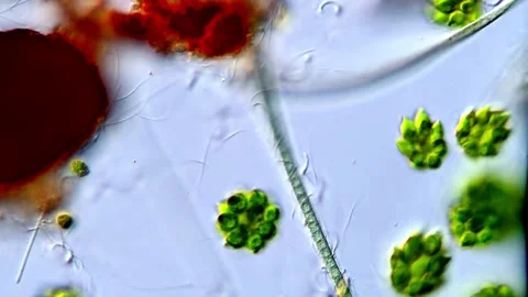 Natural Chlorophyta Algae Sample Under Microscope, 400x Stock-Footage 317789913