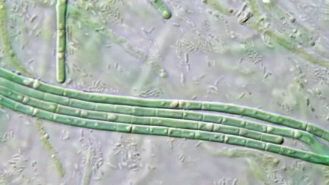 Natural Green Algae Chlorophyta Cell Structures under microscope 動画素材 310301489
