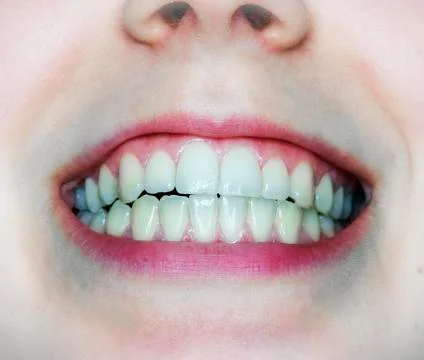 Natural teeth in a half opened woman's mouth Foto stock