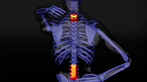 Neck &amp; Back Pain 3D Animation Stock Footage 328828273