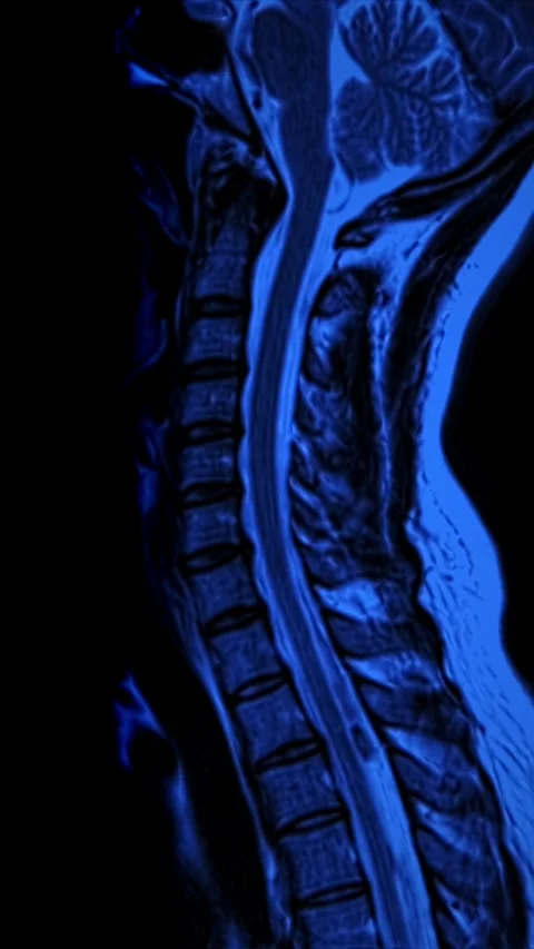 Neck MRI movement Stock Footage 260570955