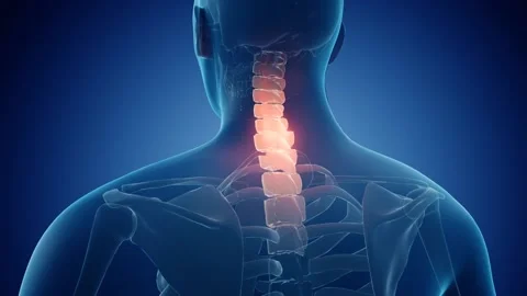 Neck Pain animation Stock Footage 189481573