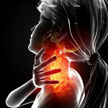 Neck pain, artwork Stock Illustration