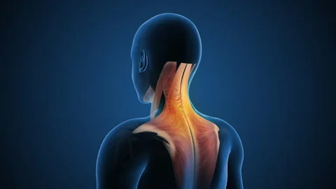 Neck Pain Associated with Cervical Posture Issues 스톡 동영상 297592500