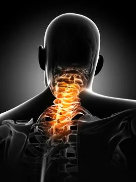 Neck pain, conceptual artwork Stock Illustration