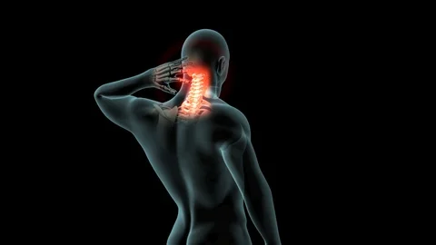 Neck Pain Stock Footage 121787204
