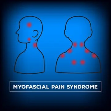 Neck pain Stock Illustration