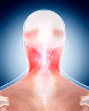 Neck pain Stock Illustration
