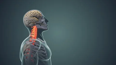 Neck pain or Cervical posture syndrome medical animation Stock Footage 245258364