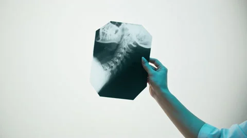 Neck x-ray close-up. Magnetic Resonance Image of Spinal Column, Skull Head Stock Footage 169198503