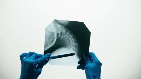 Neck x-ray close-up. Magnetic Resonance Image of Spinal Column, Skull Head Stock Footage 169198531