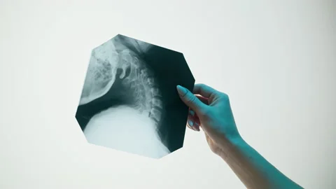 Neck x-ray close-up. Magnetic Resonance Image of Spinal Column, Skull Head Stock Footage 169198645