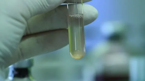 Needle dropping and drawing fluid into test tubes Stock Footage 20450330
