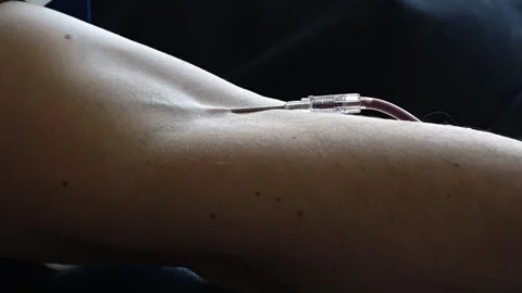 Needle into a man's vein close up Stock Footage 273591601