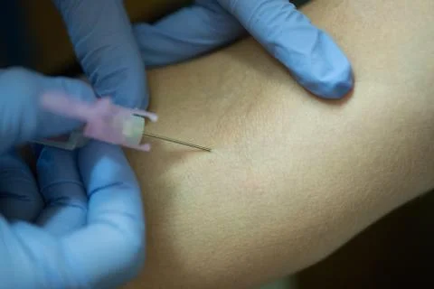 Needle Meet Vein Stock Photos