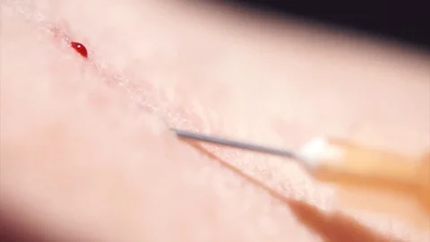 Needle piercing the skin 库存影片 74231380