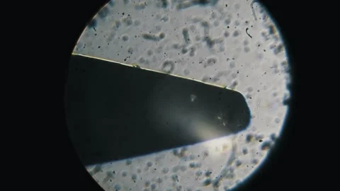 Needle Point Moving Under Optical Microscope Stock Footage 320118901