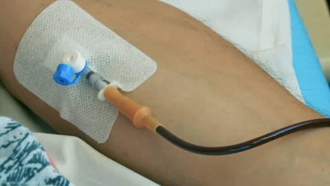 A needle in a vein Stock Footage 141437204