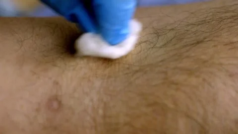 Needle into a vein Stock-Footage 265854705