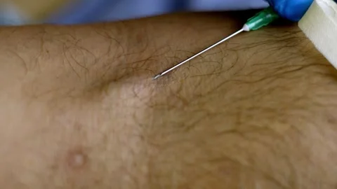 Needle into a vein 스톡 동영상 265854856