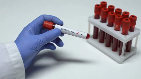 Negative Beta hCG test, doctor showing blood sample in tube, health checkup Video stock 105202543