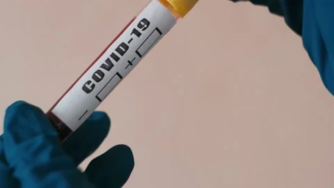 Negative blood count in vitro. Improving the condition of the patient. Stock Footage 130576443