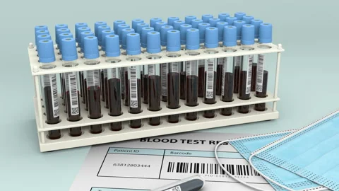 Negative blood test for virus detection with the analysis and the face masks Stock Footage 139792585