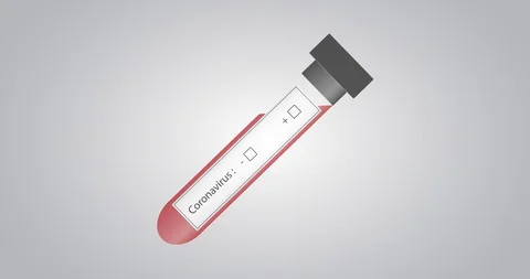 Negative coronavirus blood test. Stock Footage 128176362