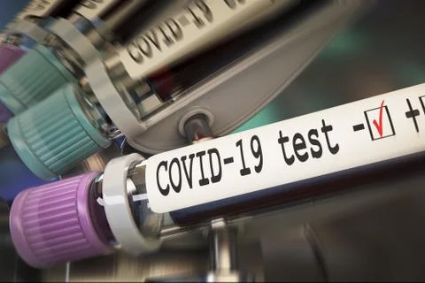 Negative COVID-19 test and laboratory sample of blood testing for diagnosis new Illustrazione stock