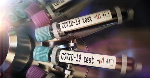 Negative COVID-19 test and laboratory sample of blood testing for diagnosis new Stock Illustration