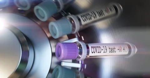 Negative COVID-19 test and laboratory sample of blood testing for diagnosis new Illustrazione stock