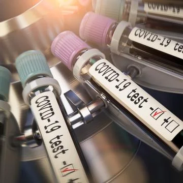 Negative COVID-19 test and laboratory sample of blood testing for diagnosis new Illustrazione stock