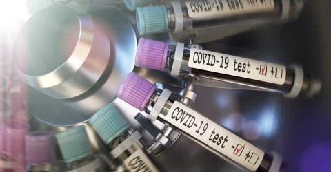 Negative COVID-19 test and laboratory sample of blood testing for diagnosis new Illustrazione stock
