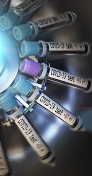Negative COVID-19 test and laboratory sample of blood testing for diagnosis new 스톡 일러스트