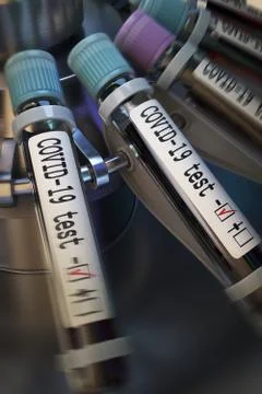 Negative COVID-19 test and laboratory sample of blood testing for diagnosis new Illustrazione stock